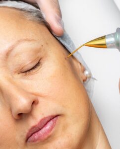 What Different Techniques Are Used for Mole Removal?