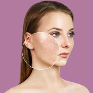 How Long Does Cold Peel in Dubai Last?