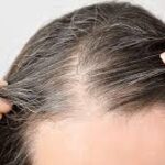 Cutting-edge-hair-loss-solution.jpg