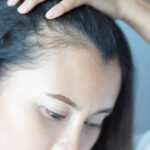Exosomes-Therapy-for-Hair-Loss-in-Riyadh-5.jpg
