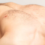 Gynecomastia-Surgery-in-Riyadh-58.jpg