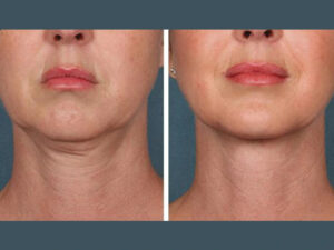 Best Doctors in Dubai for PRP Treatment and Skin Rejuvenation