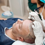 Hair-Transplant-in-Riyadh-7.png