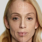 How-Can-Botox-in-Dubai-Prevent-Wrinkles.png