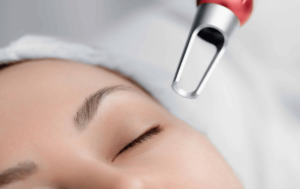 How to Care for Your Skin After Laser Treatment?
