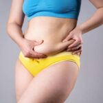 Liposuction-in-Riyadh-8.jpg