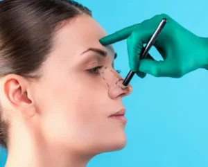 Where Are Non Surgical Nose Jobs Most Effective?