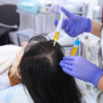 PRP-Hair-Treatment-3.jpg