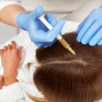 PRP-Hair-Treatment-4.jpg