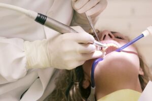 Tooth-Colored Fillings: Why They’re Becoming the New Standard