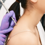 SKIN-TAG-1-861x1024.png