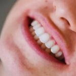 Teeth-Grinding-Mouthguard-Treatment.jpg