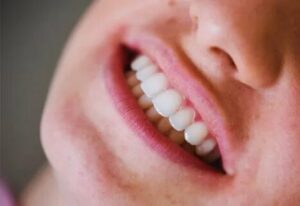 Teeth Grinding Treatment: When Is Surgery Necessary?