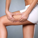 Thigh-Lift.png