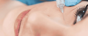 Under Eye Filler in Dubai: Combination Treatments for Enhanced Results