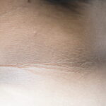 Whitening-care-for-pigmented-neck.jpg