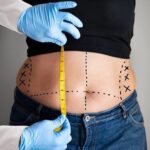 abdominoplasty-surgery-in-islamabad.jpg