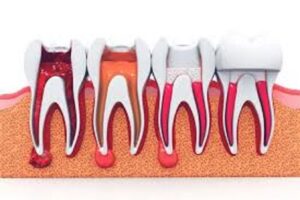 best dental clinic in kerala