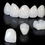 ceramic-crowns.jpg