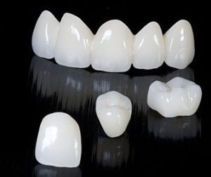 Affordable & Reliable Ceramic Crowns Cost in Islamabad