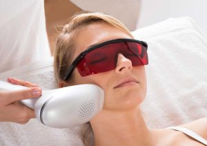 Does Laser Hair Lightening Work on Facial Hair Too?