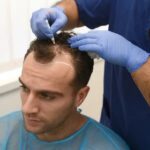 hair-transplant-in-islamabad1.jpg