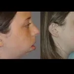 jaw-surgery-in-islamabad.webp