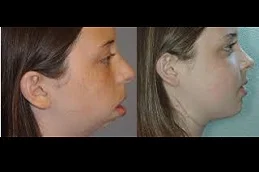 Jaw Surgery Islamabad – Advanced Orthognathic Solutions