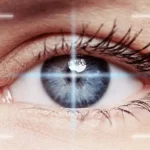 lasik-surgery-in-hindi.webp