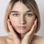resize-17607900061471666883skinpigmentationtreatmentinislamabad2.jpg