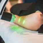 Emerald-Laser-Low-Level-Light-Therapy-used-on-Arm-Fat-Glace-Cryotherapy-Las-Vegas-320x202.jpg