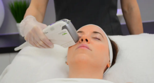 HIFU Skin Tightening Recovery: Step-by-Step Guide