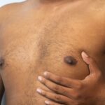 Is-Gynecomastia-Surgery-Really-Permanent-or-Can-It-Come-Back.jpg