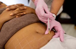 Is Lemon Bottle the Non-Surgical Fat Loss Solution Dubai’s Been Waiting For?