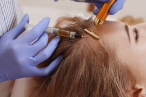Managing Expectations for PRP Hair Treatment Results