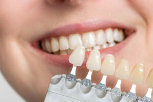 Modern Dental Veneers for a Radiant Look