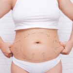 liposuction-in-islamabad.jpg