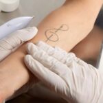 Laser-Tattoo-Removal-21.jpg