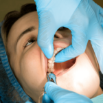 Tooth-Removal.png