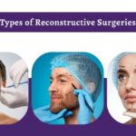 Types-of-Reconstructive-Surgeries.jpg