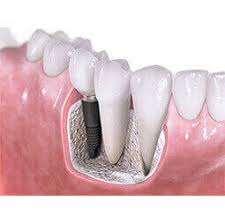 How Advanced Dental Solutions Repair Damaged Teeth Effectively