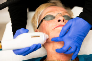 Advanced Laser Skin Resurfacing Treatments