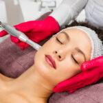 Can-RF-Microneedling-enhance-overall-skin-radiance.jpg