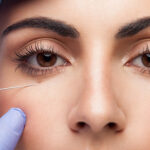 Dark-Circles-Treatment-Dubai-Abu-Dhabi.jpg