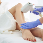 Laser-Hair-Removal-in-Islamabad.png