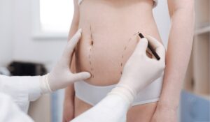 Liposuction Surgery in Dubai: Safe, Effective, and Globally Trusted