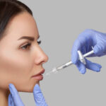 Sculptra-Fillers-3.jpg