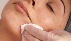 Are Chemical Peels Suitable for Sensitive Skin?