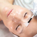 chemical-peels-in-Riyadh-9.jpg