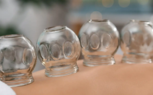 Revive Your Body’s Natural Flow with Hijama Cupping Therapy